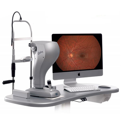 Fundus Camera